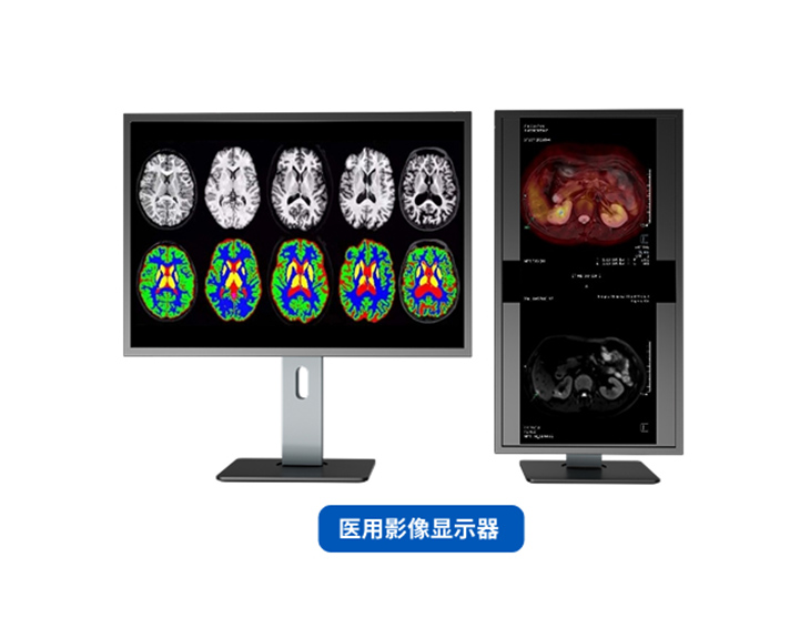 醫(yī)用影像顯示器+數(shù)字人健康助手+個人健康管理平臺